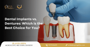 dental implants in hyderabad