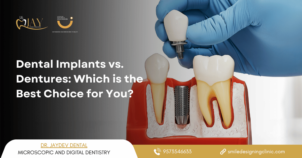 dental implants in hyderabad