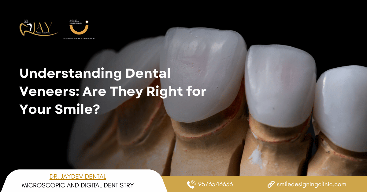full mouth dental implants in Hyderabad