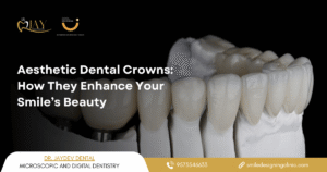 full mouth rehabilitation clinic Hyderabad