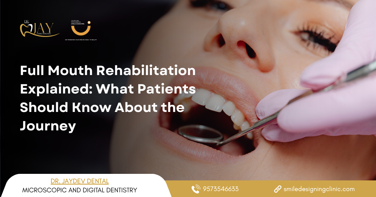 best Full Mouth Rehabilitation clinic in hyderabad