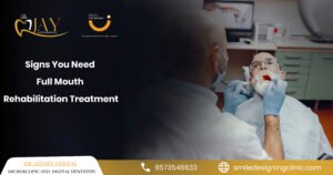 Signs You Need Full Mouth Rehabilitation Treatment