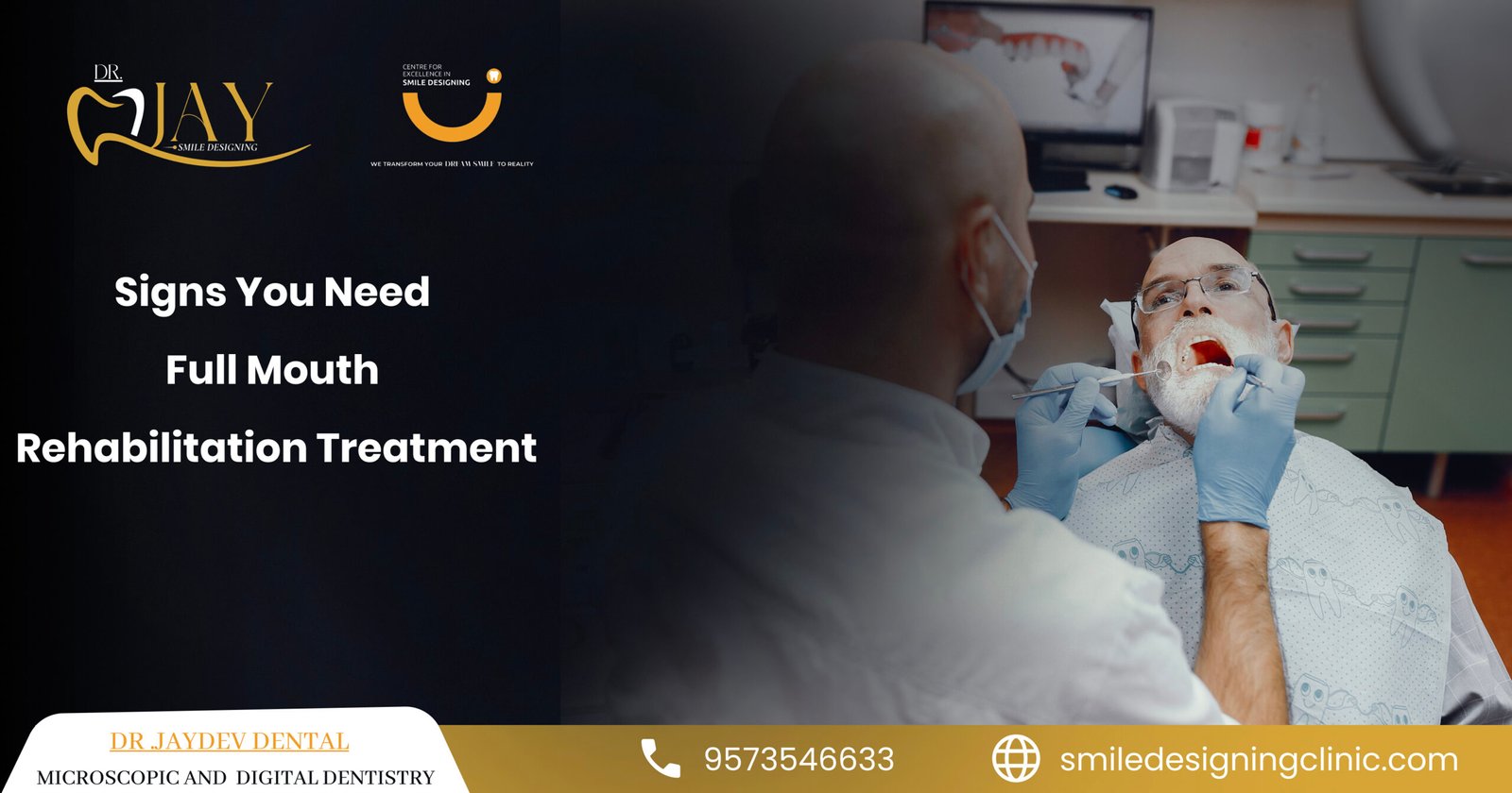 full mouth rehabilitation